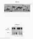 Fig. 04 - DNA encoding dipeptide-synthesizing enzyme (variants), bacterium belonging to the genus , and methods for producing dipeptides using thereof