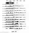 Fig. 03 - METHODS AND ASSAYS RELATING TO HUNTINGTONS DISEASE AND PARKINSON'S DISEASE