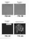 Fig. 08 - METHODS, PROBE SETS, AND KITS FOR DETECTION OF DELETION OF TUMOR SUPPRESSOR GENES BY FLUORESCENCE IN SITU HYBRIDIZATION