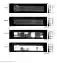 Fig. 06 - Methods for shaping high aspect ratio articles from metallic glass alloys using rapid capacitive discharge and metallic glass feedstock for use in such methods