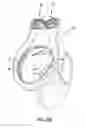 Fig. 06 - Primed siphonic flush toilet