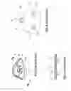 Fig. 05 - VIBRATION-REDUCING STRUCTURE FOR COMPRESSING DIAPHRAGM PUMP