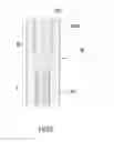 Fig. 06 - Fixing structure for casing and method for manufacturing the same