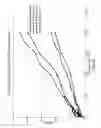Fig. 07 - Valve with a loading varying mechanism, and method of operating the same