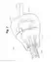 Fig. 07 - Pole clamp