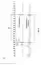 Fig. 09 - Method and apparatus for wire rope distance measurement