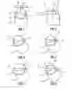 Fig. 02 - Sensor device for use in determining an angle of rotation