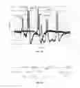 Fig. 04 - METHODS AND SYSTEMS FOR AUTOMATED BRIDGE STRUCTURAL HEALTH MONITORING