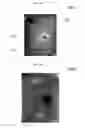 Fig. 25 - System and method for detecting a defective sample