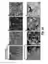 Fig. 32 - METHOD OF BIOMARKER VALIDATION AND TARGET DISCOVER