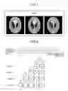 Fig. 07 - Magnetic resonance imaging apparatus and image processing apparatus