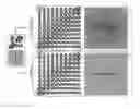 Fig. 01 - Resolution enhancement of diffusion imaging biomarkers in magnetic resonance imaging