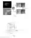 Fig. 03 - Resolution enhancement of diffusion imaging biomarkers in magnetic resonance imaging