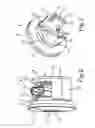 Fig. 03 - Ultrasonic sensor device comprising a reinforcement holder, arrangement, motor vehicle and corresponding method