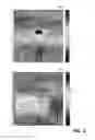 Fig. 05 - Polarized millimeter wave imaging system and method