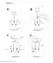 Fig. 07 - Perfusion assessment multi-modality optical medical device