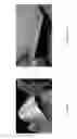 Fig. 14 - Thermal ground planes and light-emitting diodes