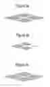 Fig. 04 - Bipolar electrode and method for producing same