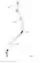 Fig. 07 - RFID-equipped hearing aid retainer