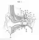 Fig. 02 - Sound capture focus adjustment for hearing prosthesis
