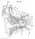 Fig. 04 - Sound capture focus adjustment for hearing prosthesis