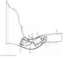 Fig. 01 - Antenna device for a hearing instrument and hearing instrument