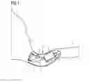 Fig. 02 - Antenna device for a hearing instrument and hearing instrument