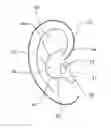 Fig. 01 - Personal hearing device