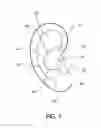 Fig. 02 - Personal hearing device