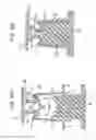 Fig. 06 - Cover removal fixture