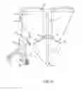 Fig. 05 - Animal hide removal apparatus