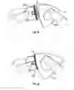 Fig. 10 - False eyelash apparatus and methods