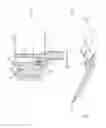 Fig. 14 - Articulating support arm