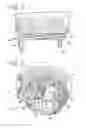 Fig. 03 - Travel beverage container