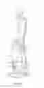 Fig. 02 - Vacuum cleaner including a removable canister assembly