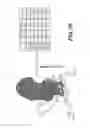 Fig. 16 - METHOD AND SYSTEM FOR PATIENT-SPECIFIC MODELING OF BLOOD FLOW