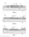 Fig. 02 - Implantable electrode and method of making the same
