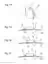 Fig. 05 - ELECTRODE AND MEASURING DEVICE FOR ACQUIRING BIOMEDICAL VITAL PARAMETERS