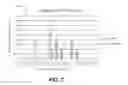 Fig. 09 - Prediction of cardiac resynchronization therapy response based on variability of repolarization