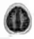 Fig. 05 - SONIFICATION OF IMAGING DATA