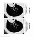 Fig. 04 - Supervised machine learning technique for reduction of radiation dose in computed tomography imaging