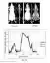 Fig. 02 - Method and system for automated detection of tissue interior to a mammalian ribcage from an in vivo image