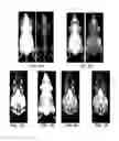 Fig. 06 - Method and system for automated detection of tissue interior to a mammalian ribcage from an in vivo image