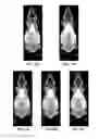 Fig. 07 - Method and system for automated detection of tissue interior to a mammalian ribcage from an in vivo image