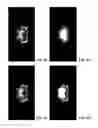 Fig. 10 - Method and system for automated detection of tissue interior to a mammalian ribcage from an in vivo image