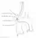 Fig. 01 - MULTI-PANE IMAGING TRANSDUCER ASSOCIATED WITH A GUIDEWIRE