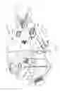 Fig. 02 - MRI biopsy device