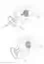 Fig. 35 - Pneumoperitoneum device