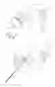 Fig. 47 - Pneumoperitoneum device