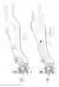 Fig. 50 - Pneumoperitoneum device